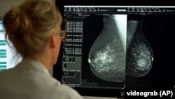 Рентген груди, который использован в исследовании о диагностике рака груди при помощи искусственного интеллекта в Лундском университете в Швеции, август 2023 года