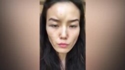 Жена казахстанского дипломата рассказала, что муж ее десять лет избивал: МИД отозвал мужчину на родину Жена казахстанского дипломата рассказала, что муж ее десять лет избивал: МИД отозвал мужчину на родину