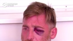 В Грузии похоронили телеоператора Лексо Лашкараву: он был избит противниками ЛГБТ-марша В Грузии похоронили телеоператора Лексо Лашкараву: он был избит противниками ЛГБТ-марша