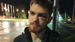 Московская полиция завела дело о перекрытии дорог на акциях в поддержку Навального. Что об этом известно? Московская полиция завела дело о перекрытии дорог на акциях в поддержку Навального. Что об этом известно?