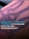"Кто с татуировкой? И начинает бить". Украинский военный рассказывает о пытках в плену из-за украинского трезубца "Кто с татуировкой? И начинает бить". Украинский военный рассказывает о пытках в плену из-за украинского трезубца