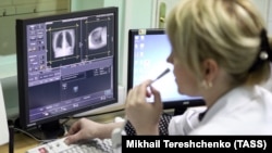 Рентген легких пациента городской поликлиники № 45 Департамента здравоохранения Москвы. Иллюстративное фото