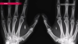 "Разве я хуже собаки?" – история о том, как рижанин стал Терминатором "Разве я хуже собаки?" – история о том, как рижанин стал Терминатором