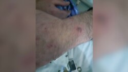 В Таджикистане три брата пожаловались на пытки, милиция обвинения отрицает В Таджикистане три брата пожаловались на пытки, милиция обвинения отрицает