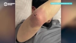 "Это однозначно пытки!" В Кыргызстане возмущены призывом не заступаться за задержанных, которых избивают силовики "Это однозначно пытки!" В Кыргызстане возмущены призывом не заступаться за задержанных, которых избивают силовики