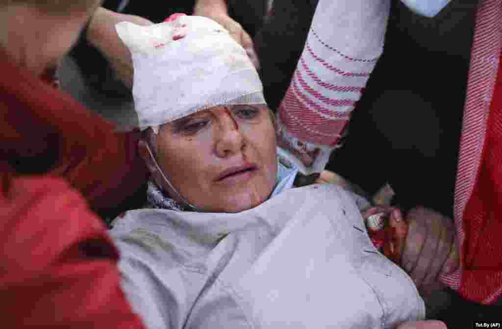 К вечеру, когда у стелы "Минск – город герой" собрались около пяти тысяч человек, силовики стали действовать крайне жестко: применялись водометы с оранжевой жидкостью вместо воды, дубинки, электрошокеры, слезоточивый газ. Есть раненые