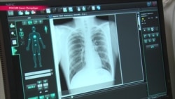 Туберкулез в России вышел за пределы "группы риска" Туберкулез в России вышел за пределы "группы риска"