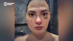 Суд в Казахстане оправдал мужа, который избил жену: как это произошло? Суд в Казахстане оправдал мужа, который избил жену: как это произошло?