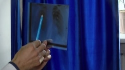 В Таджикистане врачам, работающим с больными туберкулезом, повысили зарплату до $128 В Таджикистане врачам, работающим с больными туберкулезом, повысили зарплату до $128