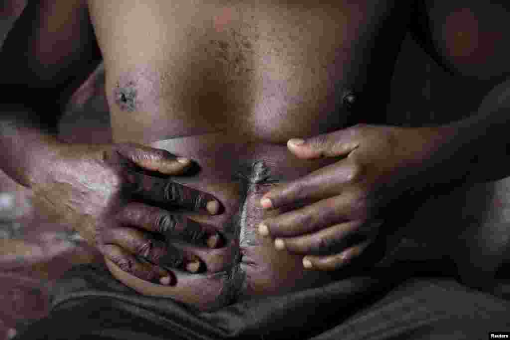 По всей Кении орудуют десятки преступных группировок. Нередко простые жители становятся жертвами перестрелок. На этого мужчину напала местная банда Макадера – преступники думали, что он – полицейский доносчик